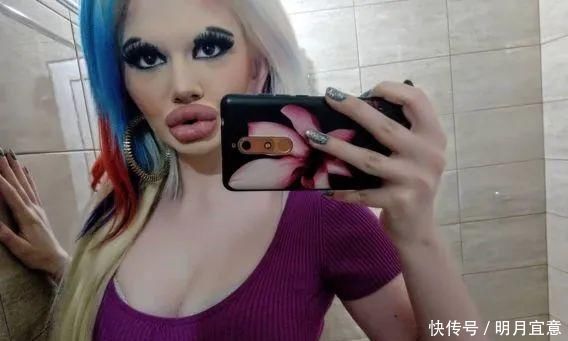 21次丰唇手术之后,这个妹子的嘴唇现在长这样…