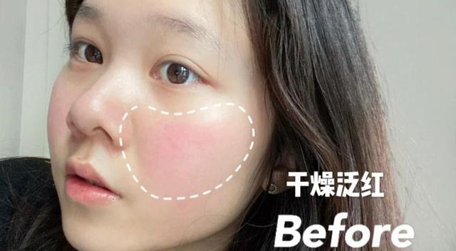 补水 秋季护肤品护肤小常识,你都知道几个!