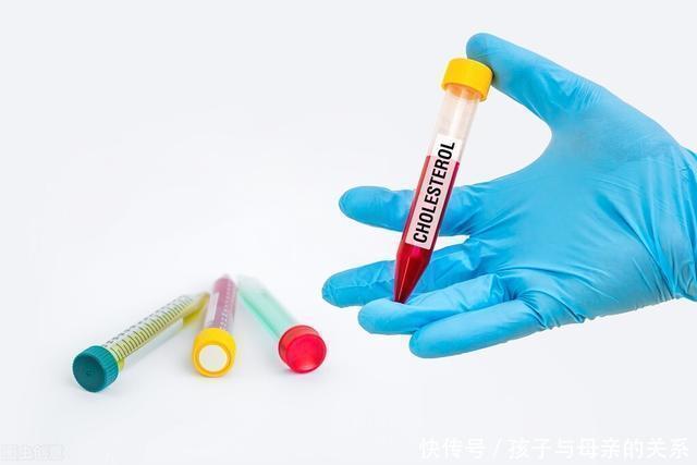 黄色瘤|退休主任:甘油三酯5.7,改掉3个坏习惯,养护血管血脂清