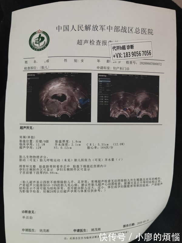 孕期做检查,B超检查or彩超b超报告单如何选