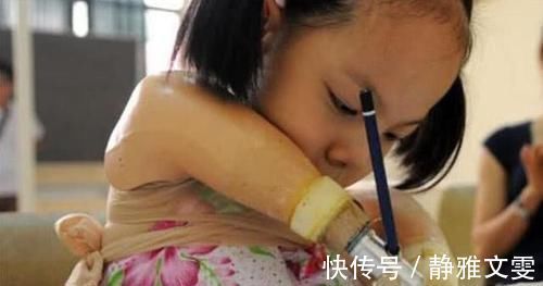 孕妇|孕妇28周被告知是“海豚胎”,家人不放弃,10年后却如此优秀