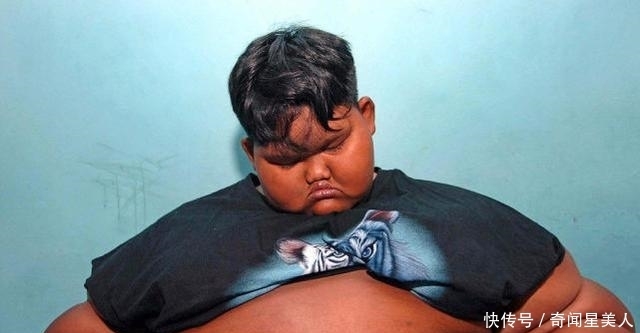 男孩|曾经那个世界最胖的男孩！体重384斤，减肥152斤后变帅小伙