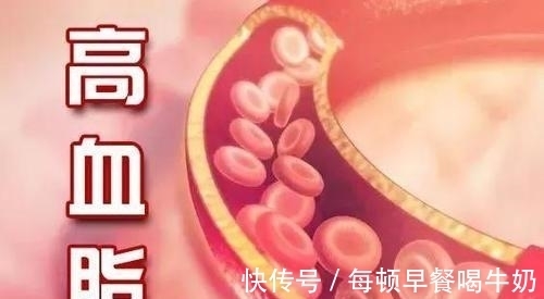 高血脂患者|76岁退休医生，研究血脂多年，建议：少吃3种食物，血脂或许稳定