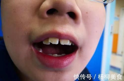 呼吸道|女儿被同学嘲笑像“青蛙”,妈妈没当一回事,朋友提醒才带去检查