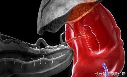 惹的祸|孩子咋吃都不长肉?可能是“脾虚”惹的祸,这三种习惯是罪魁祸首