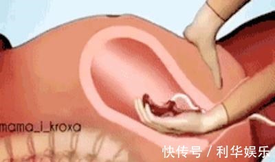 分娩|九个“产房行话”,产妇有必要提前了解,生孩子时不尴尬无压力