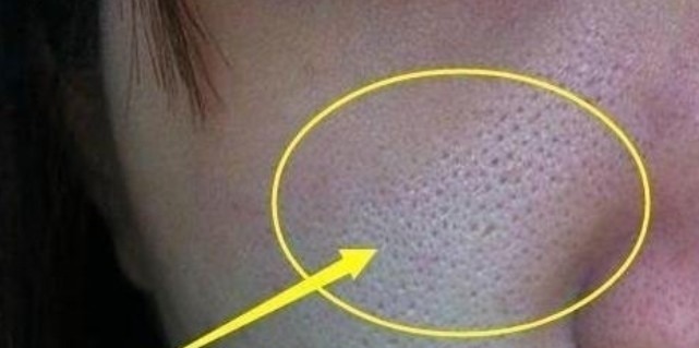 护肤 好皮肤是养出来的,记住这个护肤小技巧,不怕没有好皮肤