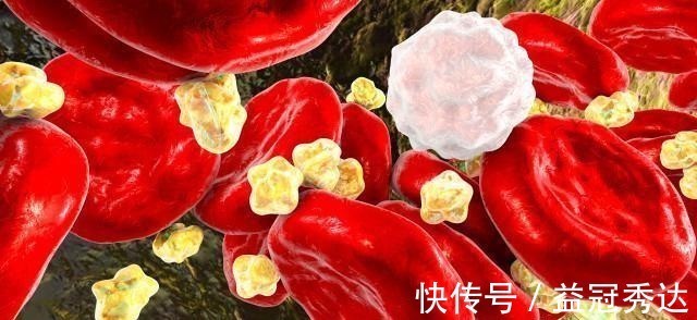 卷心菜|91岁院士研究血脂50年，提醒：3种食物会打垮高血脂“因子”