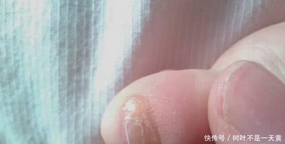 印记|炎黄子孙身上有4大独有印记,看看你是不是纯种的中国人?