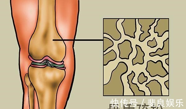 三文鱼|“养骨冠军”被找到，50岁往后，舍得吃的人，不用受骨质疏松折磨