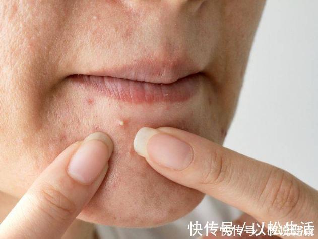 大肠经|宿便堆积,会导致便秘教你一招刺激大肠蠕动,清肠道、排出宿便