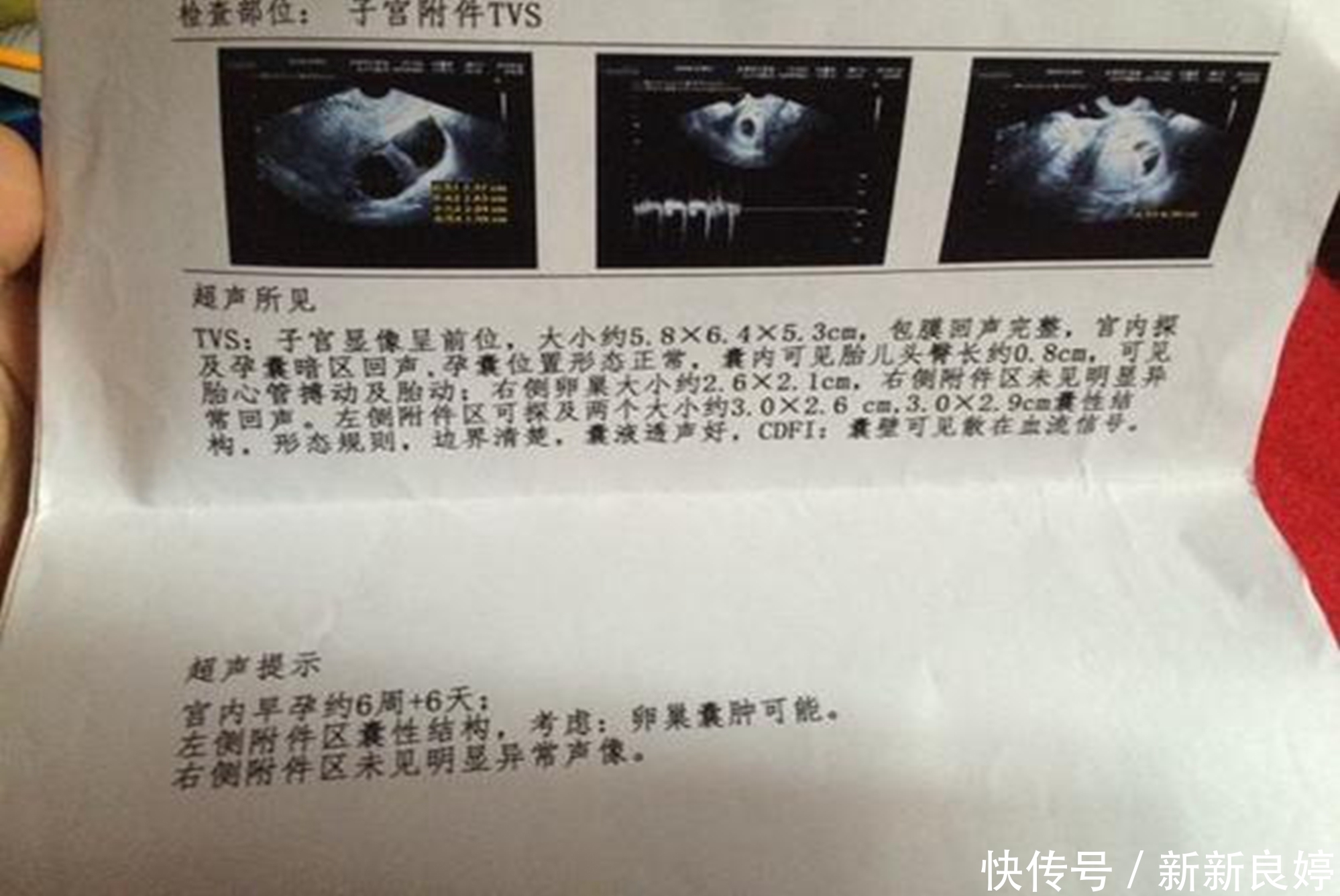 指标|孕期B超单上四个指标，暗示胎儿健康信号，达标孕妈可以放心了