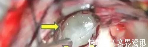 |沙雕动画,搞笑:校园最美的食堂,结果太闹心了