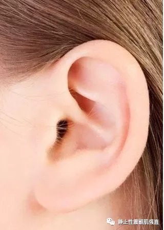 九窍|补脾,是一切疾病治疗的关键,生津润燥汤治疗干燥综合征就是如此