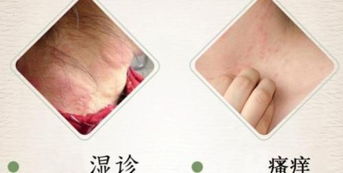 下降|肝不好，脚先知！若脚上出现5种“异常”，说明你的肝越来越差