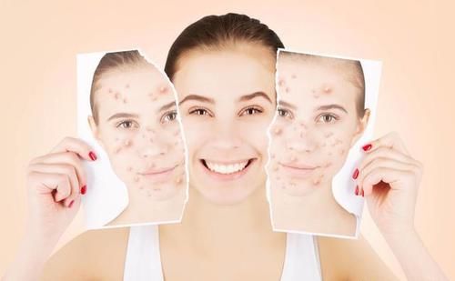 4种方法判断体内是否有热！嘴巴脱皮，牙痛，口臭是胃中有火