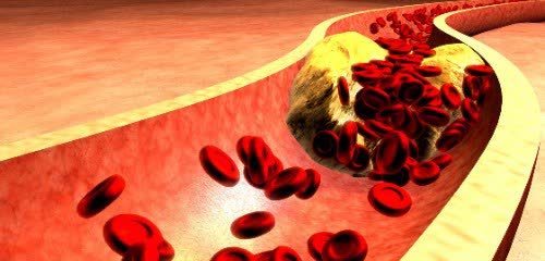 血管内皮|血管堵塞的人,睡觉会有4个表现,若1个不占,血管还很通畅