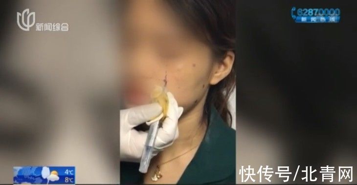 李女士 上海这家培训中心不简单！想学美容反遭毁容