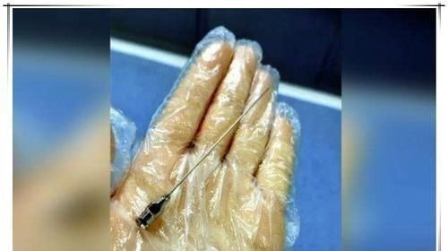 针头|宝妈剖腹产后总喊腰疼,看见剖腹产用的“针”,网友难怪了