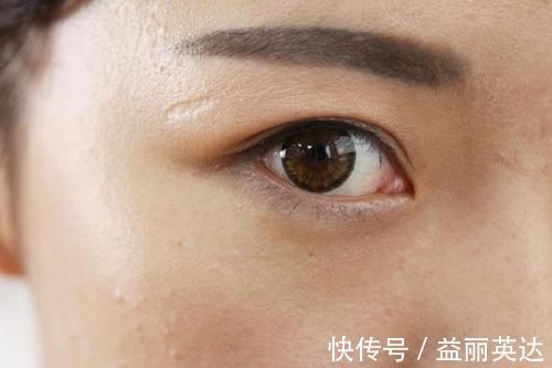 异常|肝不好的人，睡觉时出现一些现象，要是你也有，或需保肝、养肝