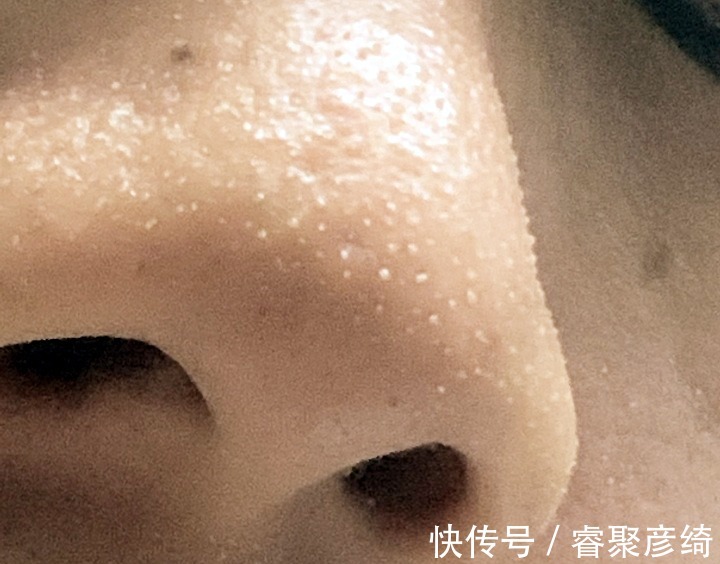 洗脸|为什么我的爽肤水不好用?