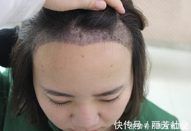 孩子|宝宝这3个部位越“大”越好,全中堪称是“福相”,中一个也很好