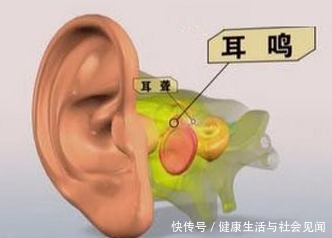 赶紧|出现这4种情况,需要赶紧“补肾”