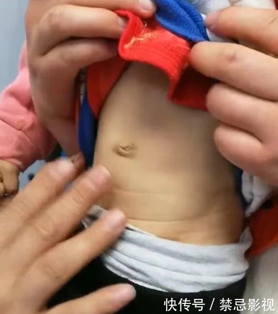 脾虚|发现没:孩子有这样的舌苔,是很难长肉长高的