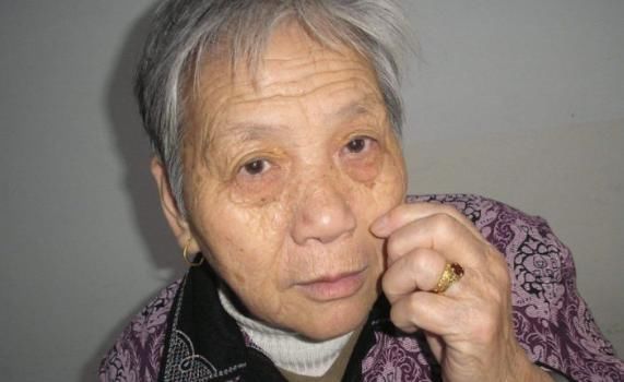 心脏病|“心脏不好脸先知”,脸上出现以下3种变化,赶紧及早查一查