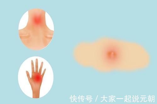 规则性|皮肤下面长出大包,是癌症信号?医生哭笑不得:满足3点才有可能