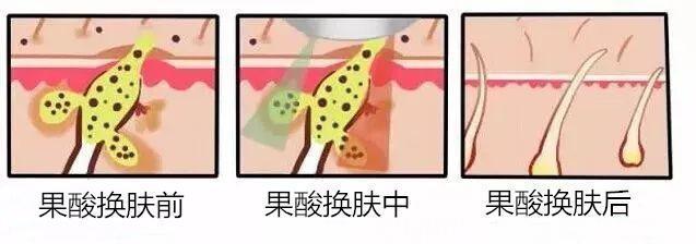 这些医美项目比你们所有的化妆品还有用!