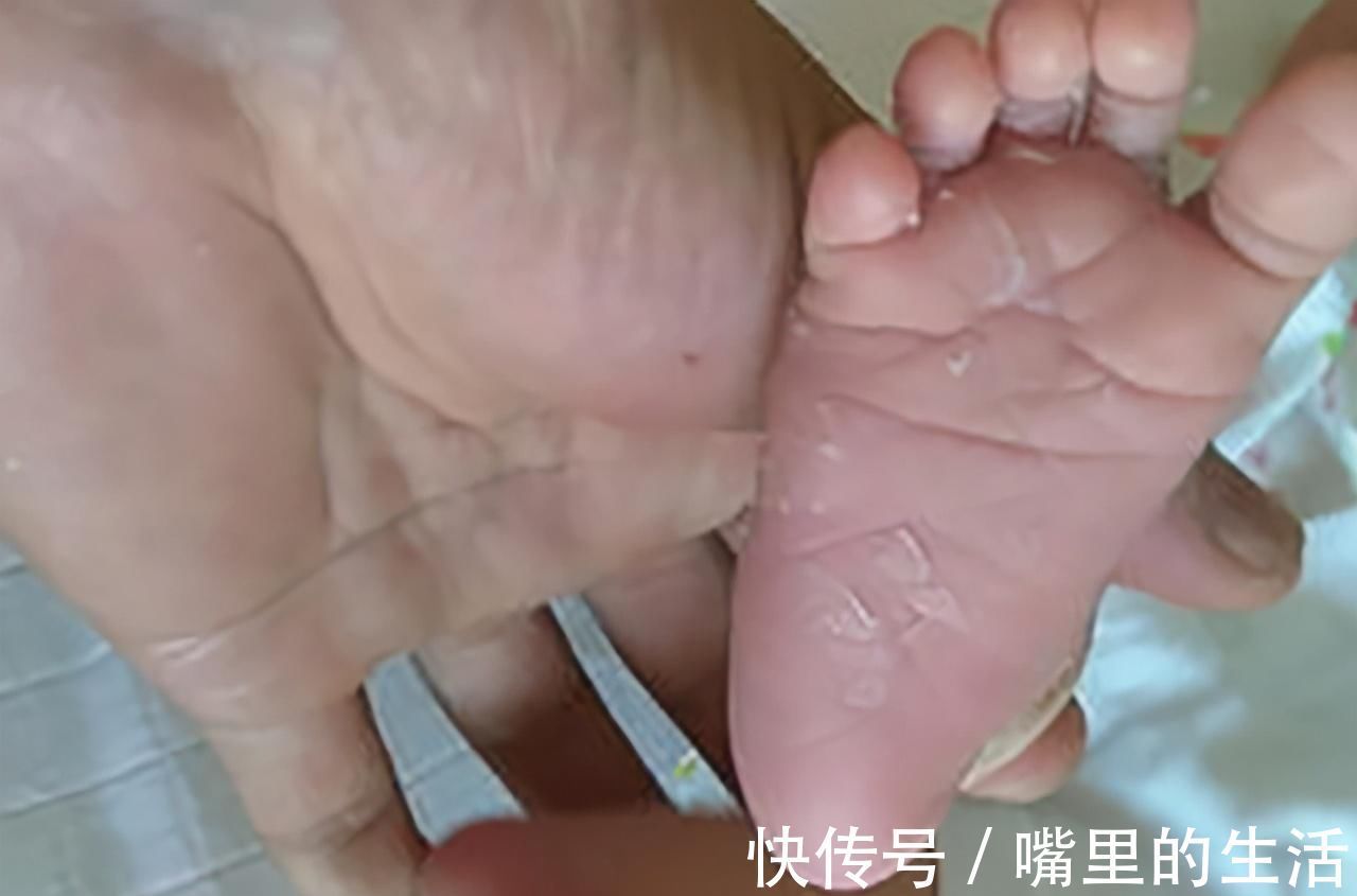 排出体外|新生儿出现这9个问题,很容易吓到妈妈,其实都是正常现象