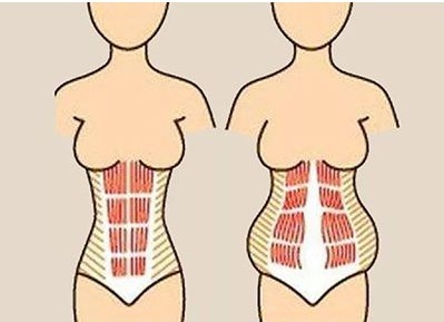宝妈|产后肚子依然圆成球,可能不是胖,而是因为这个