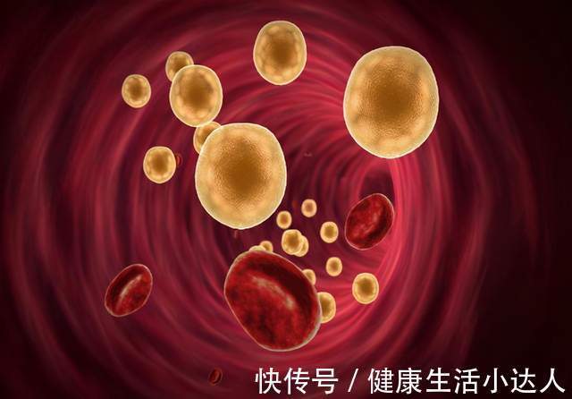 碳水化合物|血脂高了危害大，提醒：一旦臉上出現3種變化，要注意忌口了