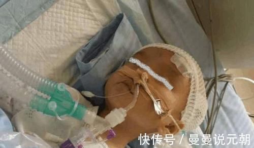 妈妈|1岁半宝宝出生时很健康,却因妈妈这一“善举”患脑瘫,别大意