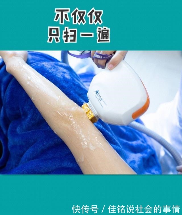 黑金超光子嫩肤 黑金超光子嫩肤真的是无痛的吗!