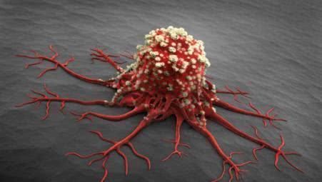 葡萄|这些食物是“癌症克星”, 经常吃一点, 能预防癌症, 癌症不上身