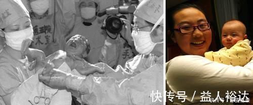 张丽珠|我国首例“试管婴儿”,如今已32岁了,她和我们究竟有什么区别?