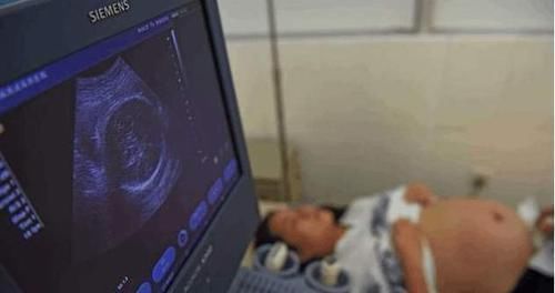 孕妇|26岁孕妇生下龙凤胎，正要缝合时她却大叫“等下”，医生满脸无奈
