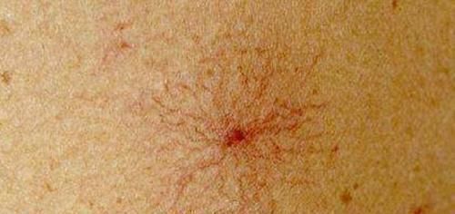 此物是天然“解毒王”,每天常吃点,养肝排毒,肝病或不攻自破