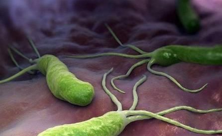 杀菌|睡前一杯“养胃水”，助你赶走幽门螺杆菌，养出好胃，早知早受益