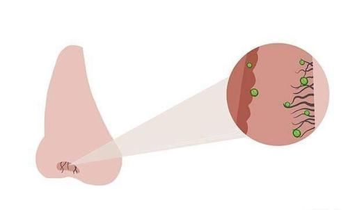 雄性激素|鼻毛长着长着就窜出来了，是暗示身体有疾？