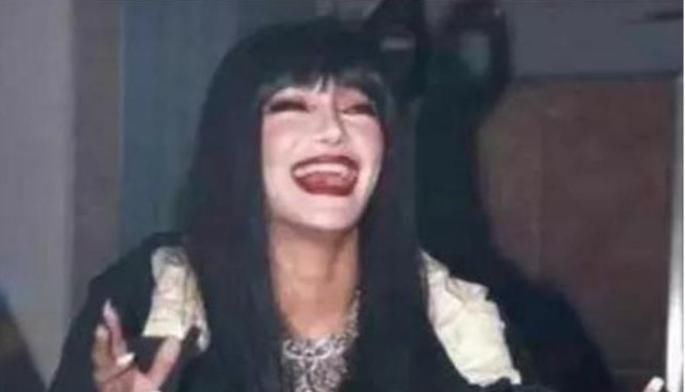 她曾是快女的冠军，整容失败后成“怪物”，只剩下眼珠是“原装的”