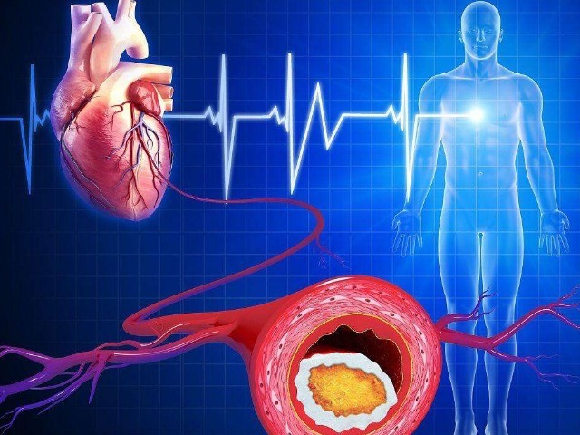脚踝|血脂太粘稠，引起动脉硬化怎么办2个小动作帮你来搞定