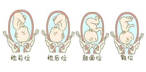 各方面|若已决定顺产生娃,孕期就要提前做准备,保障好各方面条件