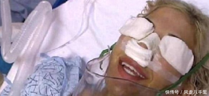 整容|女子花重金整容,一年经历13次整容手术,整容前后判若两人