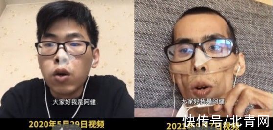 癌细胞|一针120万元！国产抗癌神药上市，首位患者出院