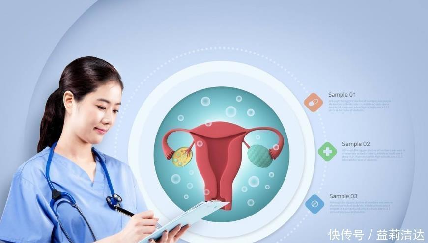 月经期间|想知道是否有“妇科疾病”，看3个标准不用去医院，在家就能自检