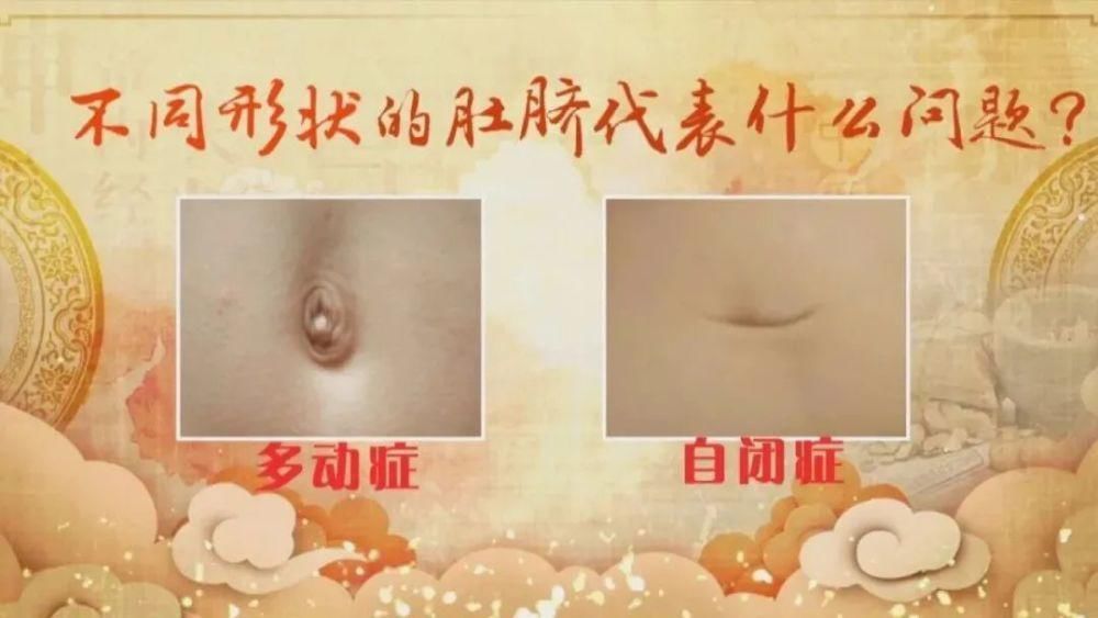 肚脐上有这3个特征，说明肾气旺，脾胃强，元气足…恭喜你易长寿