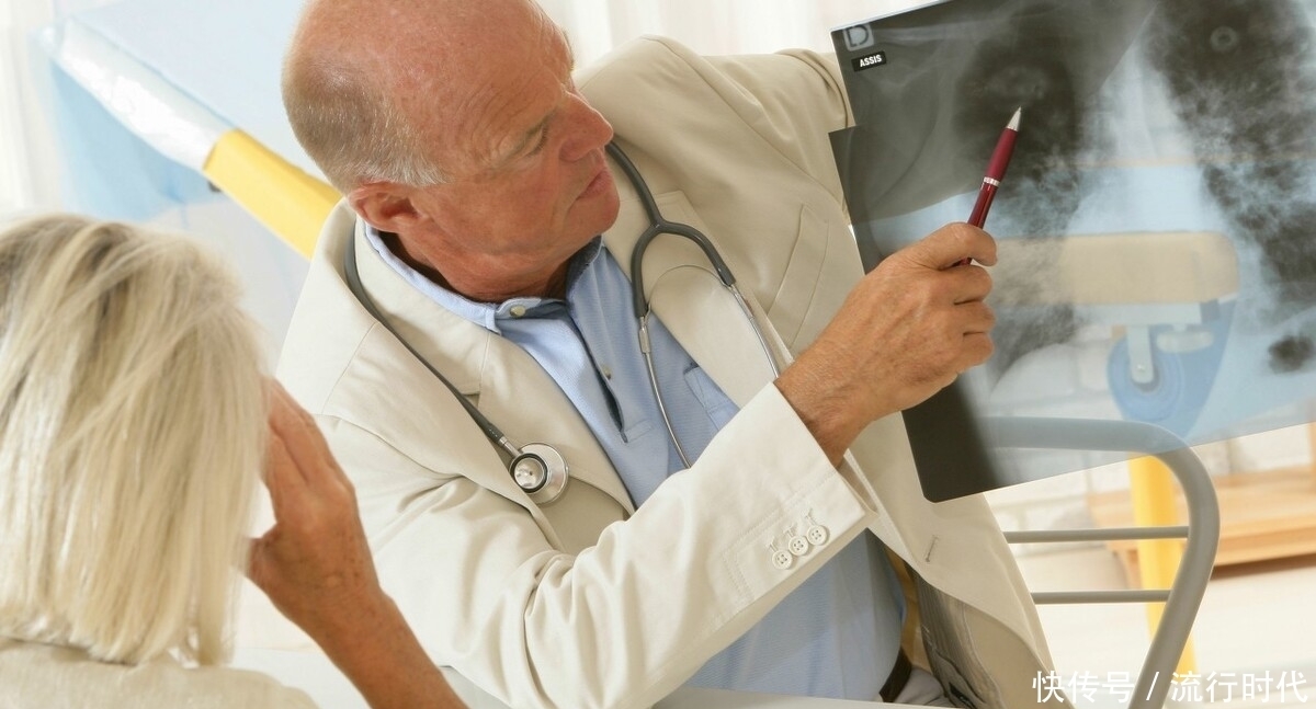 分化|肺癌的产生并非一朝一夕,要经历多久才会形成?多久会到晚期?